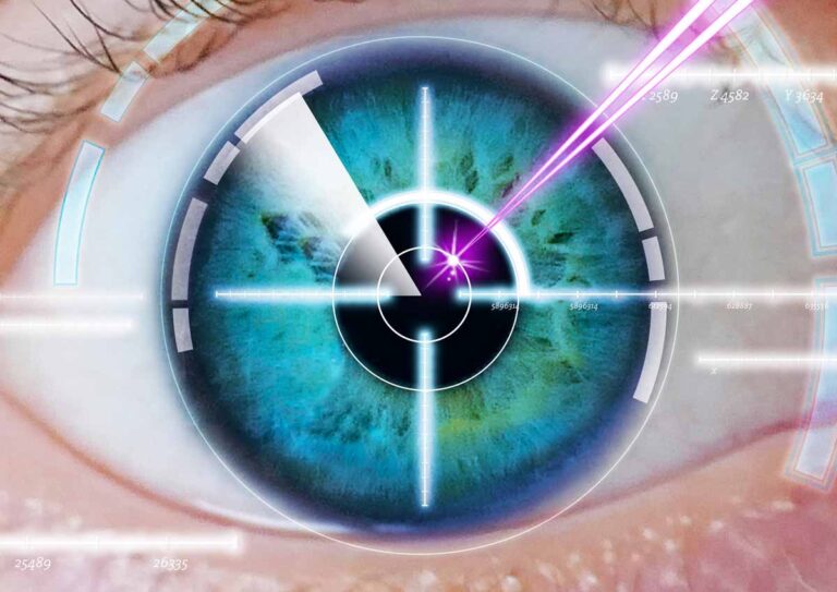 eye-measurements-lasik